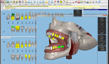 Dental4Windows