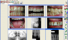 Dental4Windows